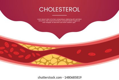 Konzeption des Cholesterin-menschlichen Vein-Konzepts für Template-Banner oder Landing-Homepage-Infografiken - Vektorgrafik