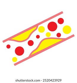 Cholesterinsymbol, Vektordesign. Symbol für Cholesterinerkrankungen. Blutgefäßverdichtungssymbol