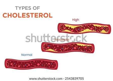 Cholesterol includes LDL (bad cholesterol), HDL (good cholesterol), and triglycerides, each affecting heart health differently by impacting blood vessels and plaque buildup.