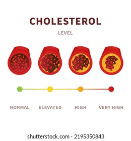 Cholesterol Level In Blood Vessel Medical Diagram. Meter Gauge Of Atherosclerosis In Coronary Artery. Ldl And Hdl Lipoprotein. High And Low Fat Test Indicator. Healthcare Concept. Vector