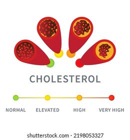 Cholesterol Level In Blood Vessel Medical Diagram. Meter Gauge Of Atherosclerosis In Coronary Artery. Ldl And Hdl Lipoprotein. High And Low Fat Test Indicator. Healthcare Concept. Vector Illustration.