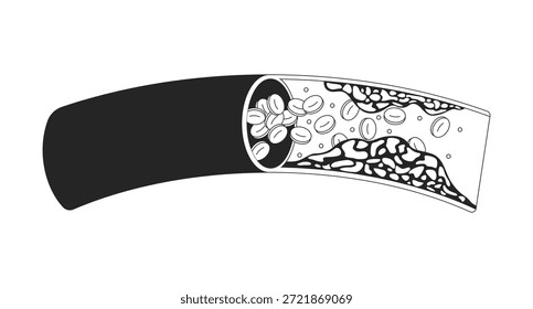 Placa de colesterol obstruindo o fluxo sanguíneo. Impedindo a circulação de glóbulos vermelhos. Doença arterial coronariana objeto de linha 2D isolado no branco. Imagem linear de tinta vetorial monocromática