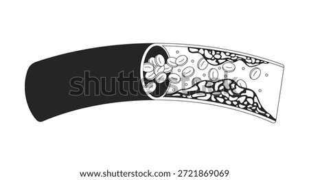 Cholesterol plaque obstructing blood flow outline illustration. Impeding red bloodcell circulation. Coronary artery disease 2D line object isolated on white. Monochrome vector ink linear image