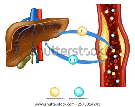 Cholesterol Transport LDL and HDL Explained. Liver and Blood Vessel Cholesterol Metabolism. Lipoproteins and Atherosclerosis.