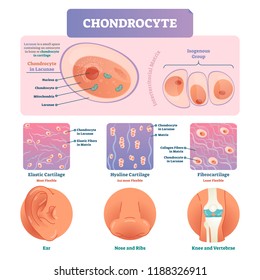 types of cartilage tissue