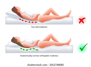 Choosing an orthopedic mattress for sleeping - Correct and incorrect sleeping position on back, vector illustration.