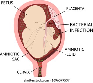 human amniotic sac
