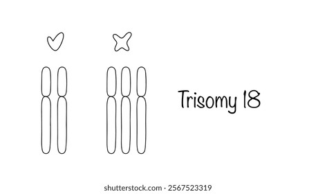 A chromosomal disorder characterized by trisomy 18. Hand drawn healthy chromosome and trisomy chromosome. Medical vector. Vector illustration.