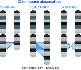 Chromosome abnormalities - deletion, duplication, inversion