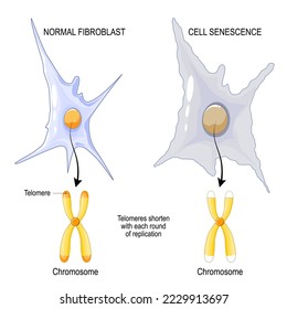 Chromosome of a Normal fibroblast and Cell senescence. Telomeres shorten with each round of replication. aging process. Vector poster