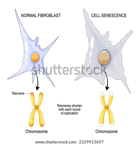 Chromosome of a Normal fibroblast and Cell senescence. Telomeres shorten with each round of replication. aging process. Vector poster