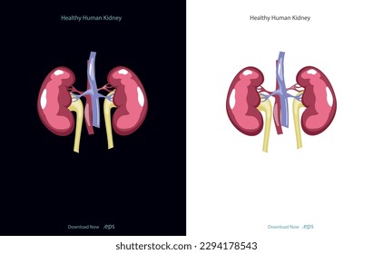 La enfermedad renal crónica, también llamada insuficiencia renal crónica, implica una pérdida gradual de la función renal. Sus riñones no pueden filtrar desechos y excedentes de fluidos de su sangre. Ilustración vectorial.