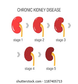 Chronic Kidney Disease (CKD) Concept. Vector Illustration In Flat Style