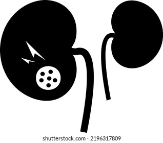 Chronic Kidney Disease Icon. Explore Full Set Of Kidney Disease Icons Made For Your Next Design Project. 