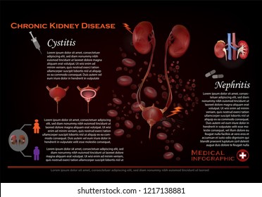 Chronic kidney disease infographic 