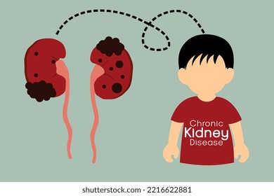 Chronic Kidney Disease. Mysterious Acute Kidney Failure In Children. Vector Illustration