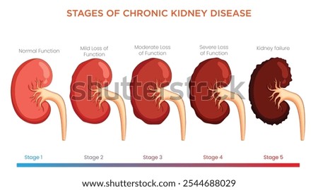 Chronic Kidney Disease progresses in stages from mild (stage 1) to severe (stage 5), with worsening kidney function, leading to waste buildup and potential dialysis need.