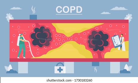 Enfermedad pulmonar obstructiva crónica o EPOC. El pulmón tiene problemas respiratorios y un flujo de aire pobre. Limpiar alveolos en vasos sanguíneos. Ilustración vectorial en diseño plano.