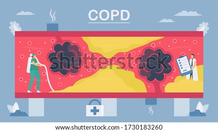 Chronic obstructive pulmonary disease or COPD. Lung have breathing problems and poor airflow. To clean alveoli in blood vessel. Vector illustration in flat design.