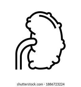 chronic pyelonephritis line icon vector. chronic pyelonephritis sign. isolated contour symbol black illustration