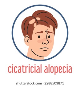 Vector de alopecia ciatrial aislado. Retrato de hombre triste, pérdida de pelo, condición médica. Enfermedad autoinmune. Cefalea, condición insalubre.