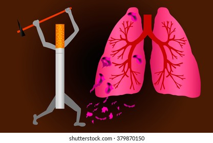 Cigarette attacks the lungs