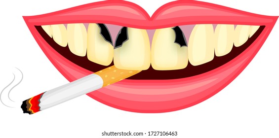 Cigarette in human mouth. Smoking causes damage to the teeth. World no tobacco day. Illustration isolated on white background.