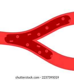 Vektorgrafik des Kreislaufsystems auf weißem Hintergrund. Mangel an roten Blutkörperchen. Amemia-Konzept.