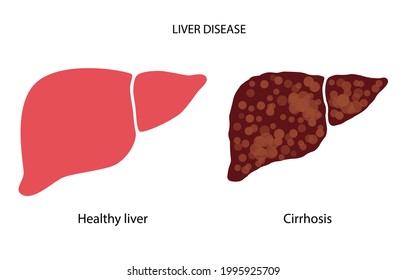 84 Internal scar tissue Images, Stock Photos & Vectors | Shutterstock