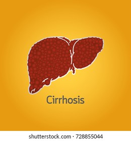 Cirrhosis vector logo icon illustration