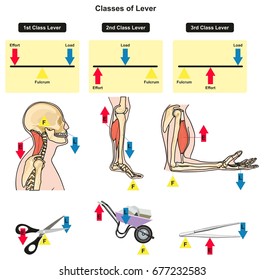 Classes of Lever infographic diagram showing parts and types including fulcrum load and effort with examples of human body joints bones and muscles daily lives for physics science education