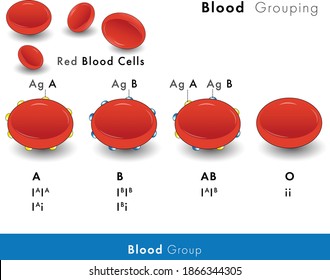 classification of Blood group infographic vector. RBCs showing surface antigen: A, B and O type, serum. red blood cells, blood typing or grouping. Blood typing and hemagglutination