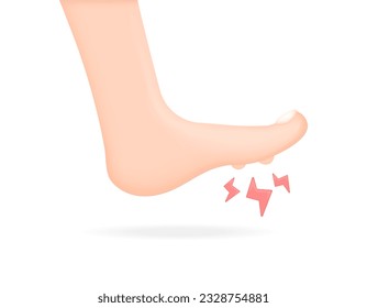 Enfermedad de Clavus. Hay un bulto de pez sobre la suela del pie. los nódulos en la pierna son dolorosos o dolorosos. problemas de salud. Diseño de ilustración 3D minimalista. elementos vectores. fondo blanco