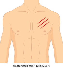 Claw vector. Body lesion. vector. free space for text. wallpaper. 