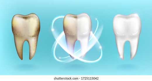 teeth cavity protection