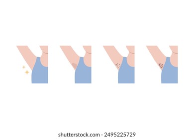 Clean and hairy dark problem underarm armpit icon set. Before and after. Hair remove, beauty, laser treatment, waxing, body care concepts. Flat vector design isolated on white background illustration.