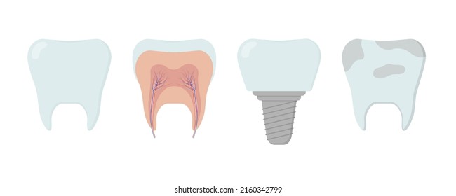 Clean healthy tooth, dental implant, dirty tooth, tooth inside. Template for stomatology or dentistry template. Isolated vector illustration