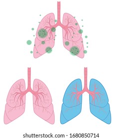 clean lungs set for medicine. Coronavirus respiratory.