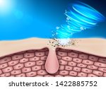 Clean the skin Remove dirt and ingrained Keep the skin deeply clean Without dirt clogging The cause of acne and dermatitis.
Vector Realistic file.