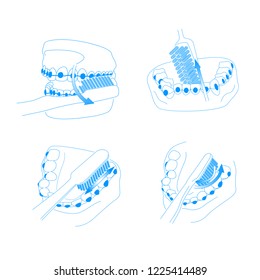 cleaning braces systems vector dental illustration for infographic, brochure and postrer