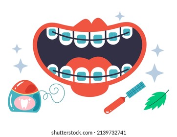 Cleaning brackets system tools. Vector flat graphic design cartoon illustration set