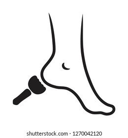  Cleaning the rough skin, calluses on the heels. Dry foot woman. - Vector