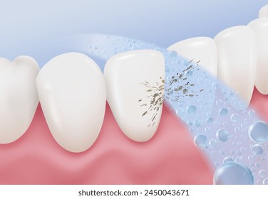 Cleaning teeth removes plaque and dirt between the teeth. Make your teeth white and clean. Advertising media for fluoride toothpaste, mouthwash, dental clinics. Realistic vector file.