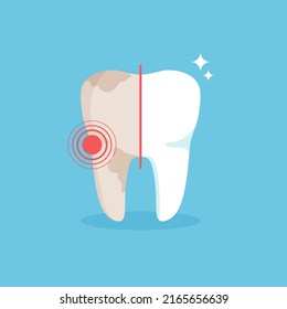 Cleaning teeth. Sick tooth. Before and after treatment. Dental health concept. Vector illustration isolated on blue background.