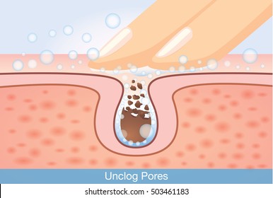 Cleaning Unclog Pores With Hand. This Illustration About Skin Care And Beauty.
