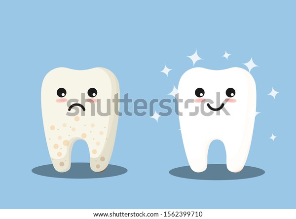 歯のクリーニングと白化のコンセプトベクターイラスト Happy Toothとyellow Moody Toothのカートーンキャラクターをフラットデザインに インフォグラフィックエレメントをホワイトニングする前と後の歯 のベクター画像素材 ロイヤリティフリー