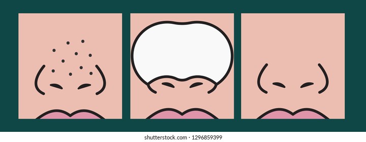 Cleansing of blackheads on nose cosmetic stripsб dots on nose. Patches for cleaning skin. Home skin care. Vector illustration