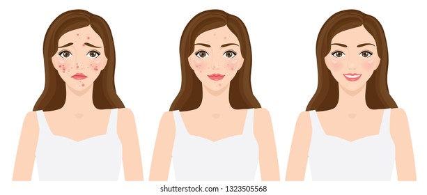 Clear Of Acne , Skin Problems Vector Illustration