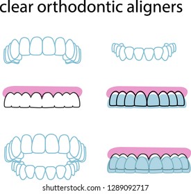 Clear Aligners Vector