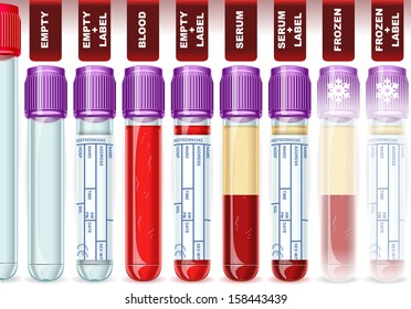 Clinic Hematology Test Complete Set Tester Tube Laboratory Equipment Serum Test Tube Blood Tester Vial Healthcare Clinic Hospital Blood Hematology Serum Infographic Element 3D Vial Vector Illustration